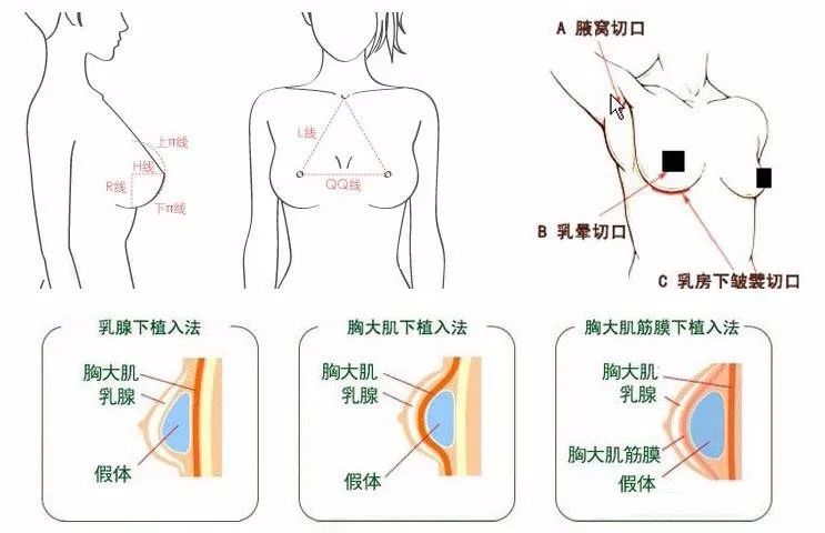 讲真，蔡依林到底是怎么从“平平无奇”变身人间胸器的？